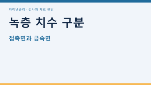 녹층 치수 구분